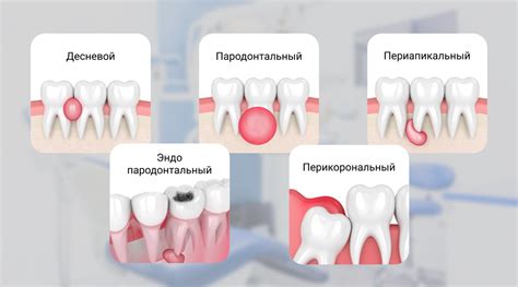 Абсцесс на десне: что делать после вскрытия