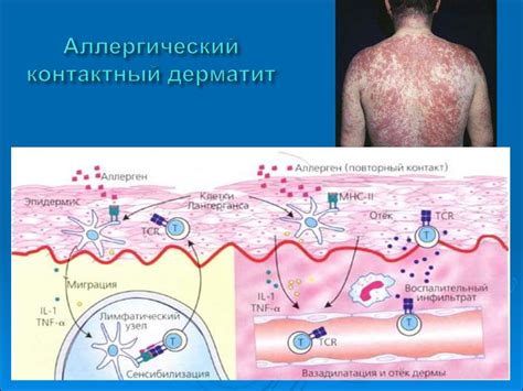 Аллергические реакции и абразии