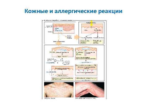 Аллергические реакции и кожные проявления