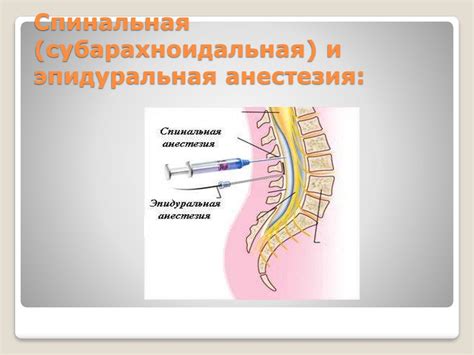 Анестезия и перенос еды