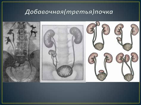 Аномалии мочеполовой системы и врожденные патологии