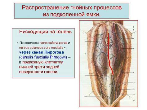 Антибиотики как основной метод лечения гнойных процессов