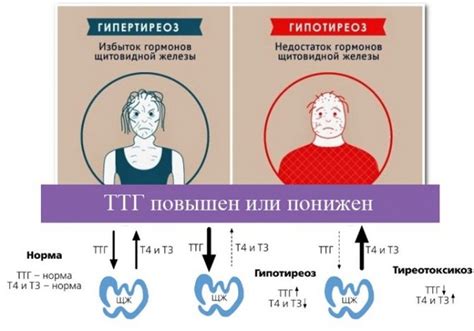 Безопасные методы повышения уровня ТТГ у женщин