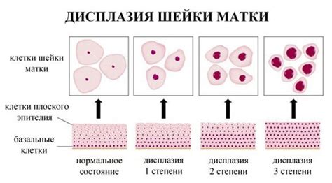 Важность расшифровки цитологического класса 1 Папаниколау