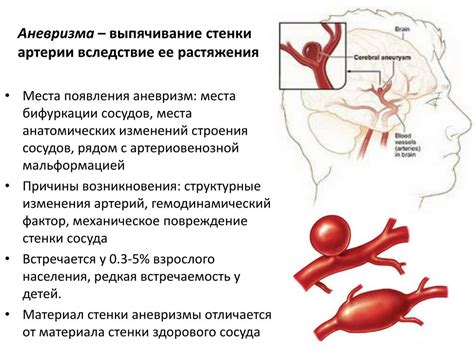 Вестибулярные расстройства: совместные симптомы с артериовенозной мальформацией