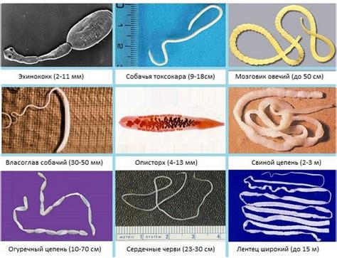 Виды глистов и паразитов