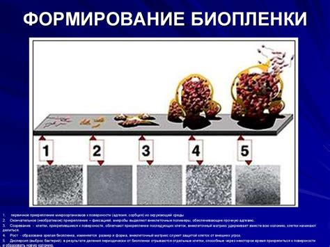 Влияние происхождения инфильтративных изменений