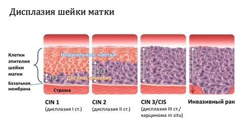 Возможные диагнозы при цитологическом классе 1 Папаниколау