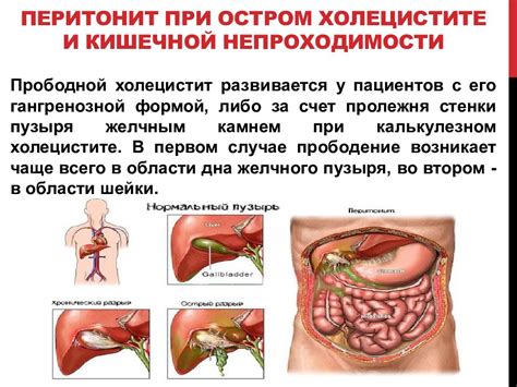 Возможные заболевания, приводящие к икоте