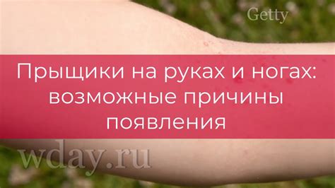 Возможные причины прыщей на руках