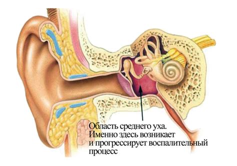 Возможные решения воспаления уха у взрослого