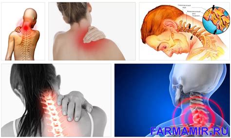 Воспаление в шейном отделе позвоночника