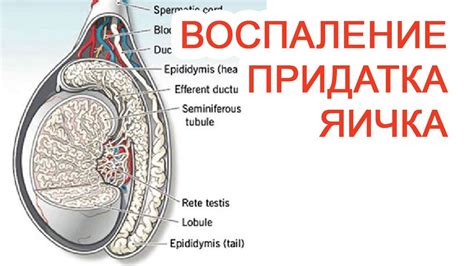 Воспаление левого яичка