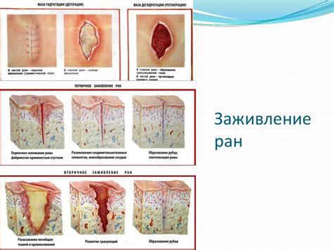 Воспаление раны и инфекция