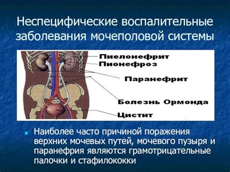 Воспалительные заболевания мочеполовой системы