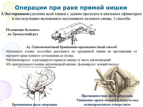 Восстановление после операции на прямой кишке: что нужно знать