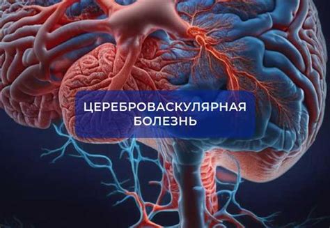 Врожденные аномалии сосудов