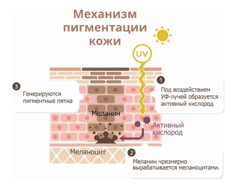 Вторая причина: нарушения пигментации кожи