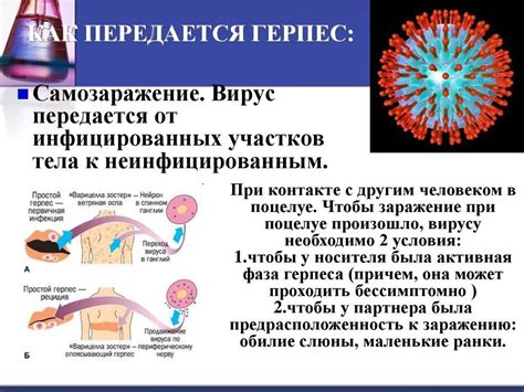 Герпетическая инфекция