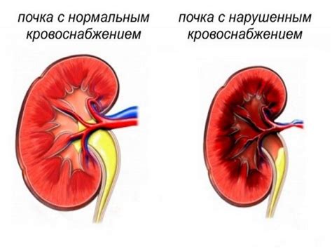 Главные причины почечных проблем