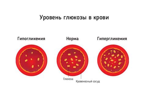 Глюкоза в рационе: как правильно ее употреблять после операции