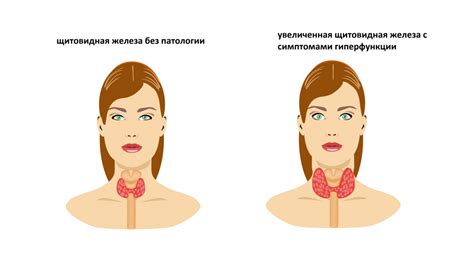 Гормон ТТГ: что это и зачем он нужен?