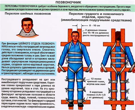 Действия при обнаружении перелома позвоночника