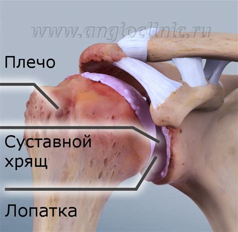 Диагностика дистрофии плечевого сустава 1 степени