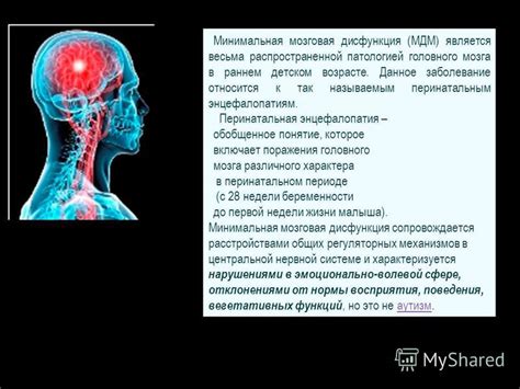 Диагностика и обследование при подозрении на дисфункцию неспецифических срединных структур головного мозга