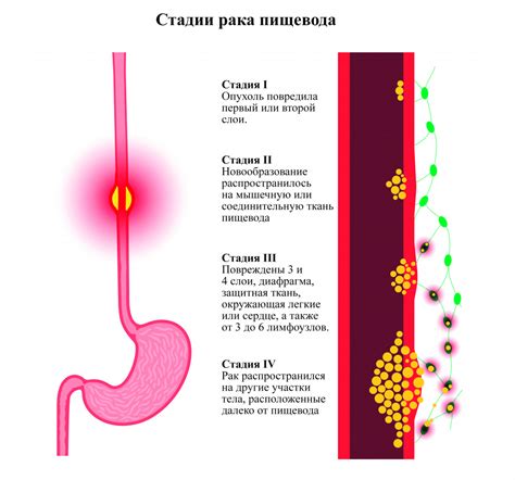 Диагностика и симптомы