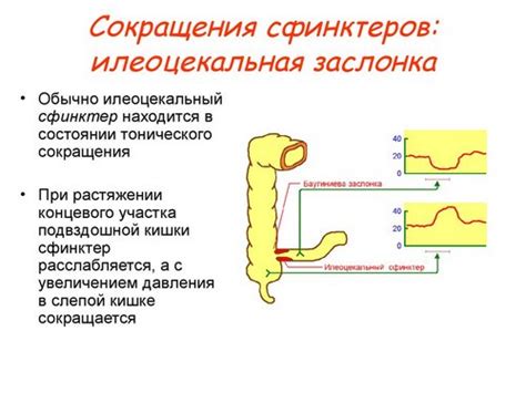 Диагностика недостаточности баугиниевой заслонки