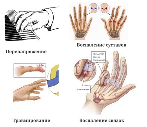 Диагностика немощи пальцев