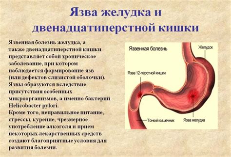 Диагностика ощущения лопания в животе