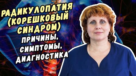 Диагностика радикулопатии