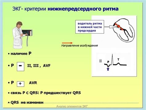 Диагностика эктопического правопредсердного ритма у ребенка