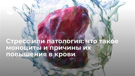 Завышены моноциты: медицинские заболевания