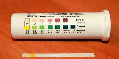 Значение обнаружения 0,5 кетонов в моче для организма