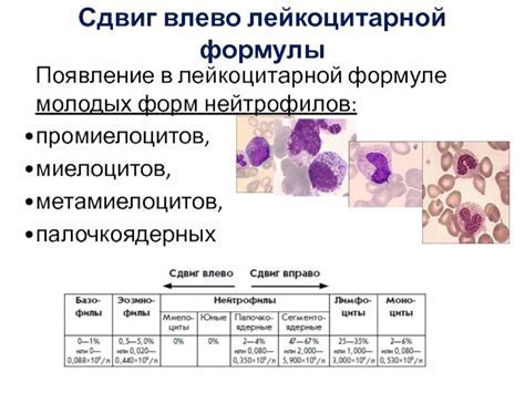 Значение повышенных нейтрофилов и пониженных лимфоцитов