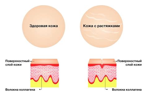 Изменения веса и растяжки