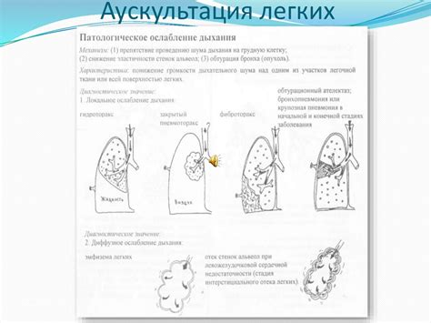 Интерпретация исследования Картинок лёгких