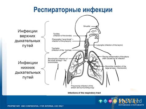 Инфекции дыхательных путей