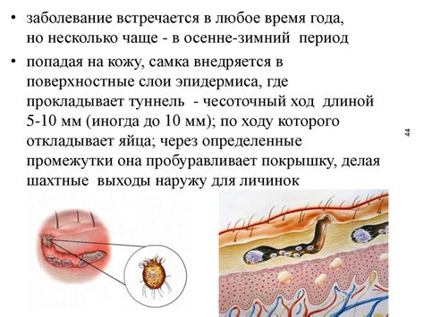 Инфекционные и паразитарные заболевания, вызывающие зуд