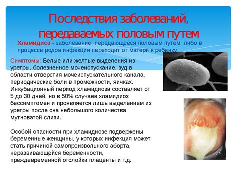 Инфекция, передаваемая половым путем