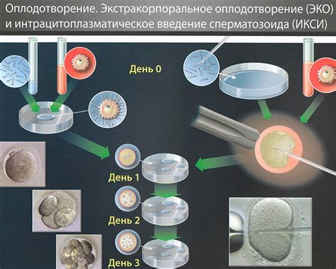 Использование методов искусственного оплодотворения