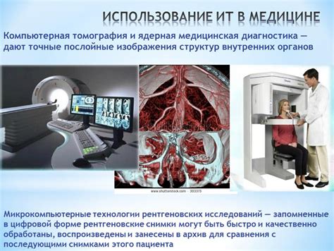 Использование принципа АБС в медицине