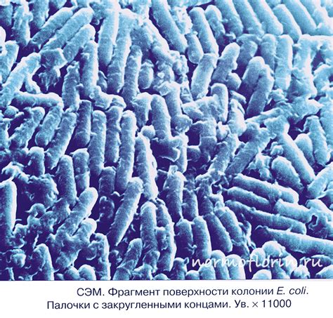 Какая роль у Escherichia coli в организме женщины