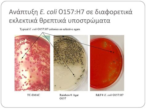 Какие симптомы сопровождают инфекцию Escherichia coli у женщин