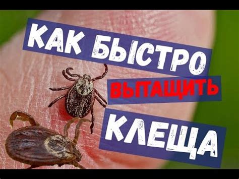 Как безопасно извлечь клеща самостоятельно