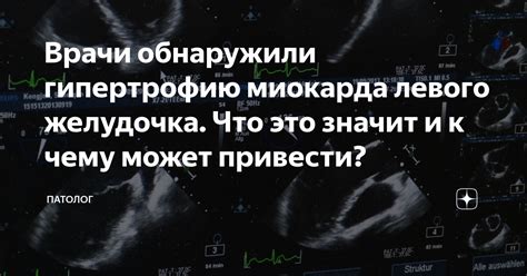 Как врачи диагностируют гипертрофию левого желудочка?