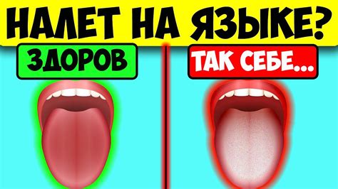 Как избавиться от черного налета на языке?